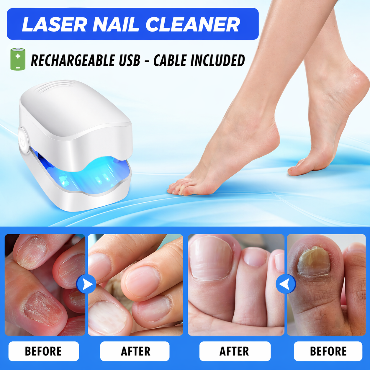 NexFungi Eliminates fungi and infection