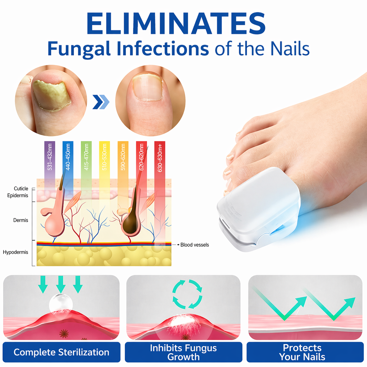 NexFungi Eliminates fungi and infection