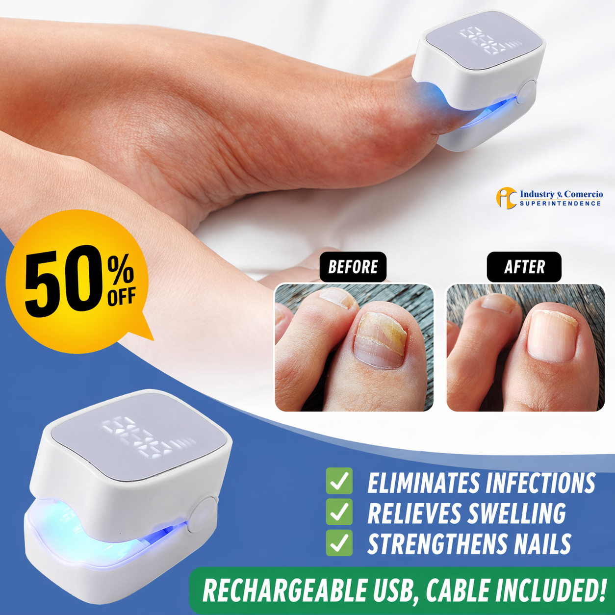 NexFungi Eliminates fungi and infection