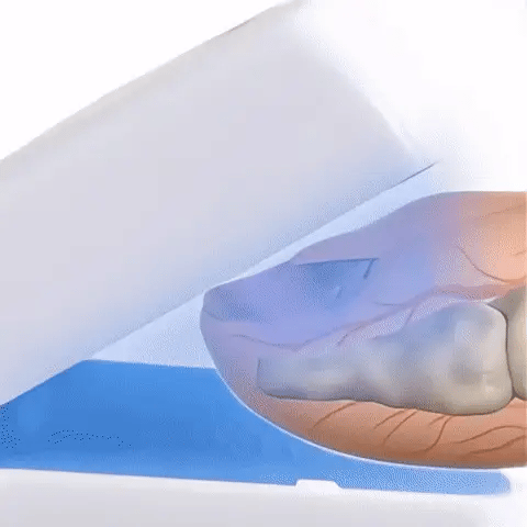 NexFungi Eliminates fungi and infection